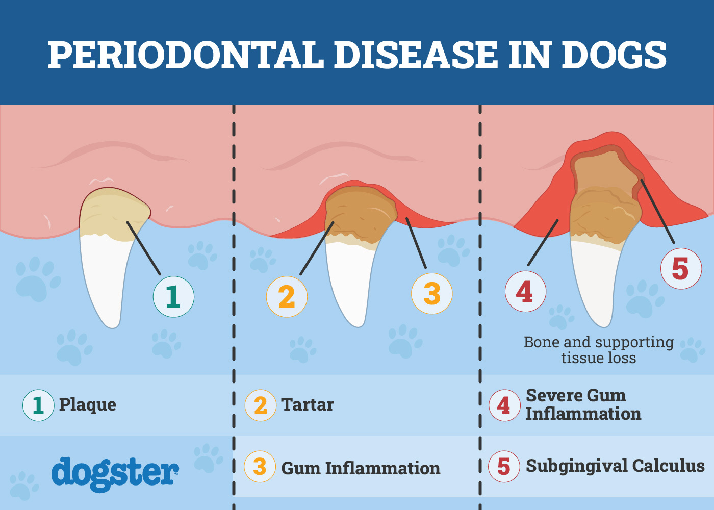 Periodontal Disease