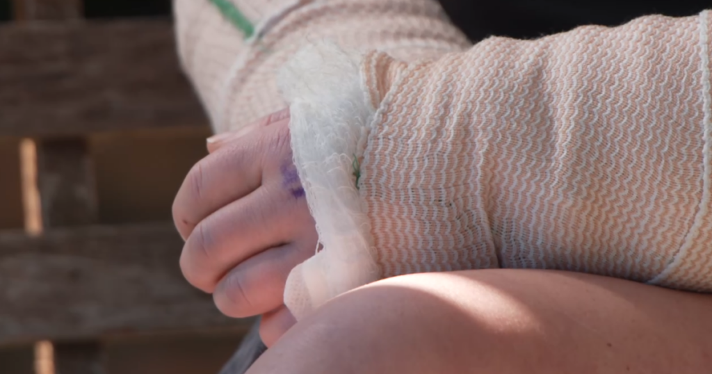 Hamilton County Dog Warden calls for law reform as dogs that mauled Colerain Township woman remain nearby - WCPO 9 Cincinnati 2 wp header logo 207